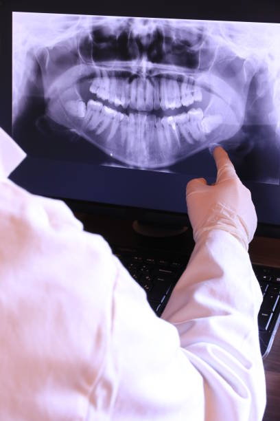 Best Emergency Dentist for Lost Fillings or Crowns in View Park Windsor Hills, CA