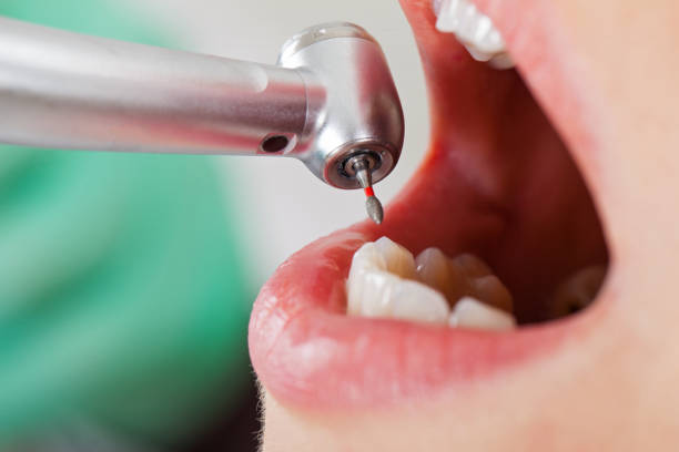 Best Emergency Dentist for Knocked-Out Tooth in View Park Windsor Hills, CA